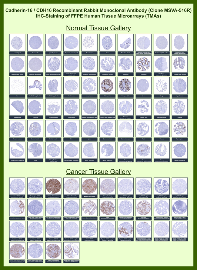 Ksp-Cadherin (Kidney-Specific Cadherin)/CDH16 Antibody in Immunohistochemistry (Paraffin) (IHC (P))