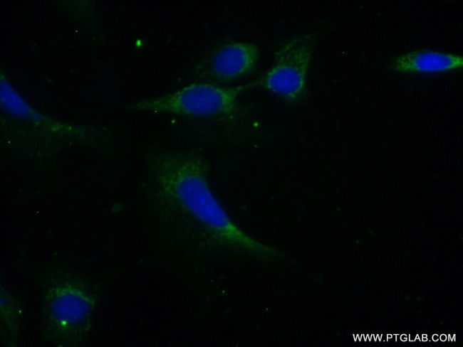 PPP1CB Antibody in Immunocytochemistry (ICC/IF)