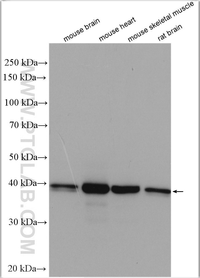 TMOD1 Antibody in Western Blot (WB)