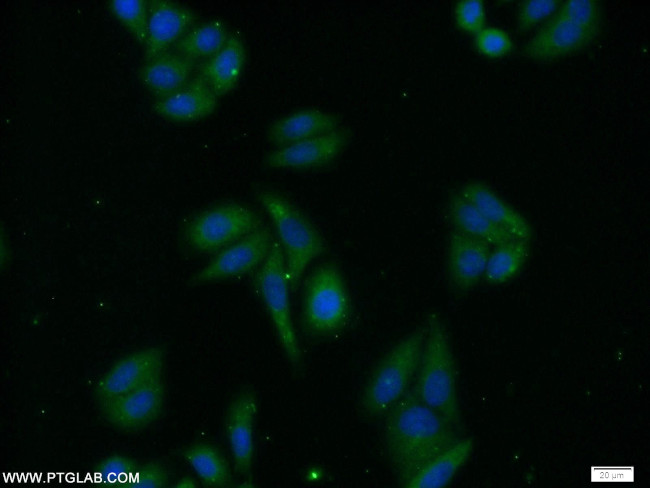 PREB Antibody in Immunocytochemistry (ICC/IF)