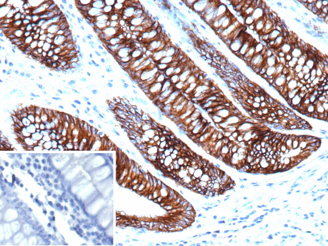 Cadherin 17/LI Cadherin (Gastric Adenocarcinoma Marker) Antibody in Immunohistochemistry (Paraffin) (IHC (P))