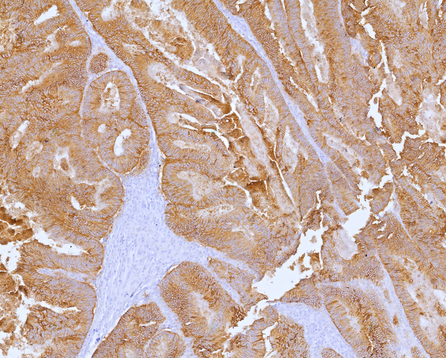 Cadherin 17/LI Cadherin (Gastric Adenocarcinoma Marker) Antibody in Immunohistochemistry (Paraffin) (IHC (P))