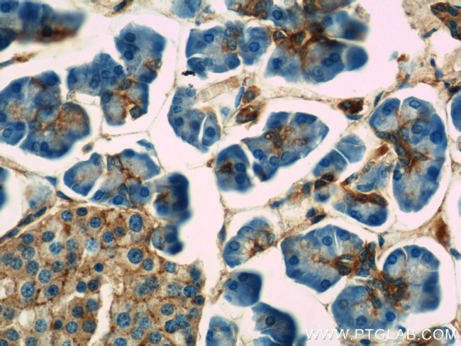 Annexin VII Antibody in Immunohistochemistry (Paraffin) (IHC (P))