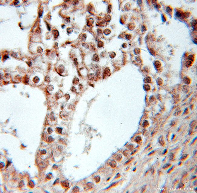 PPARD Antibody in Immunohistochemistry (Paraffin) (IHC (P))