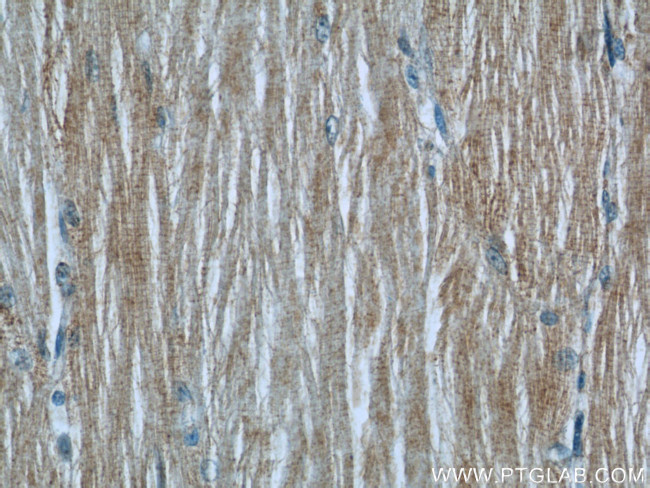 TUSC4 Antibody in Immunohistochemistry (Paraffin) (IHC (P))
