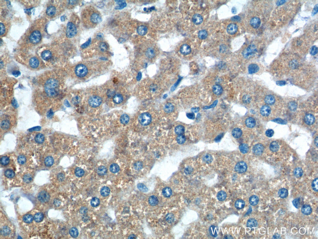 TAOK3 Antibody in Immunohistochemistry (Paraffin) (IHC (P))