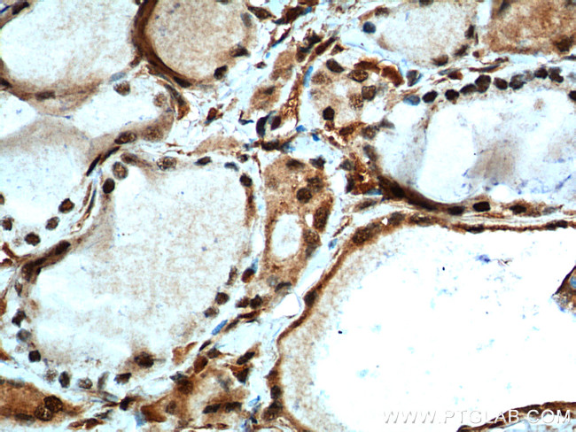 MYCN Antibody in Immunohistochemistry (Paraffin) (IHC (P))