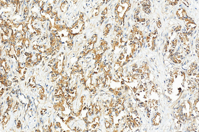 TAP2 Antibody in Immunohistochemistry (Paraffin) (IHC (P))