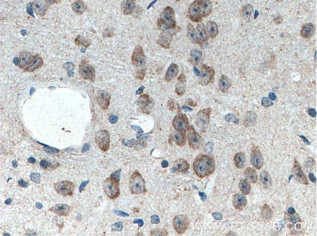 C17orf81 Antibody in Immunohistochemistry (Paraffin) (IHC (P))
