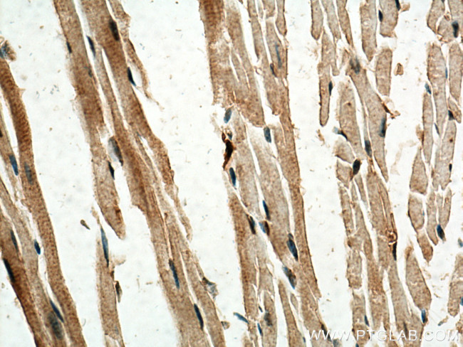 SERTAD1 Antibody in Immunohistochemistry (Paraffin) (IHC (P))