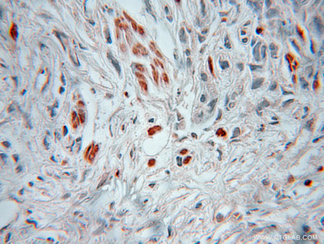 HSBP1 Antibody in Immunohistochemistry (Paraffin) (IHC (P))