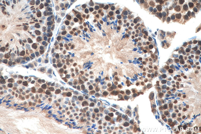 GTF2H1 Antibody in Immunohistochemistry (Paraffin) (IHC (P))