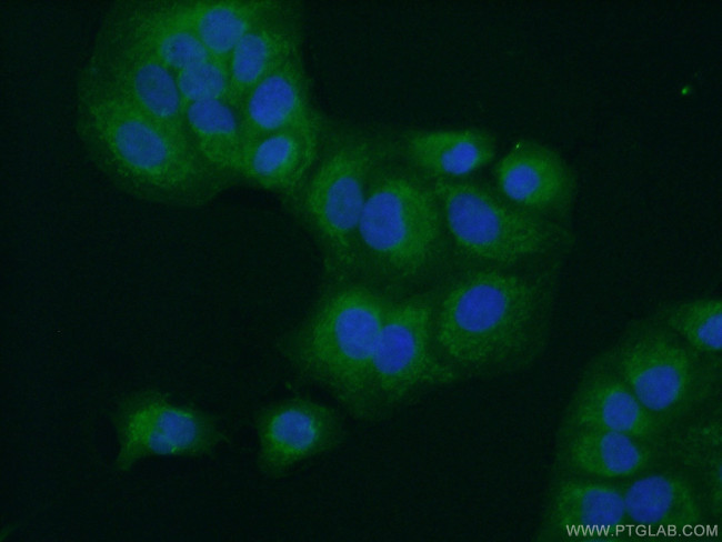 BCS1L Antibody in Immunocytochemistry (ICC/IF)