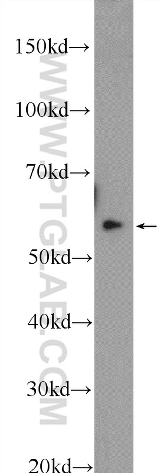 TBRG4 Antibody in Western Blot (WB)