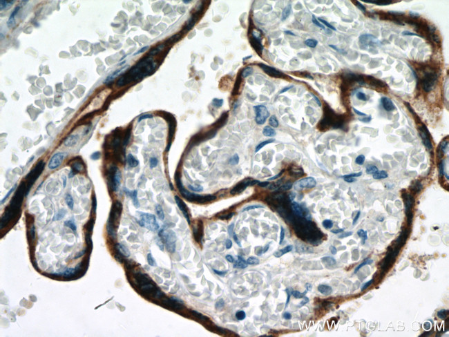 Placental lactogen Antibody in Immunohistochemistry (Paraffin) (IHC (P))