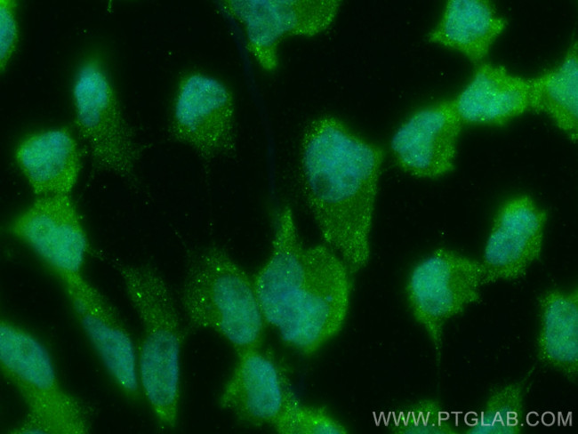 RNF216 Antibody in Immunocytochemistry (ICC/IF)