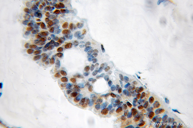 GNL2 Antibody in Immunohistochemistry (Paraffin) (IHC (P))