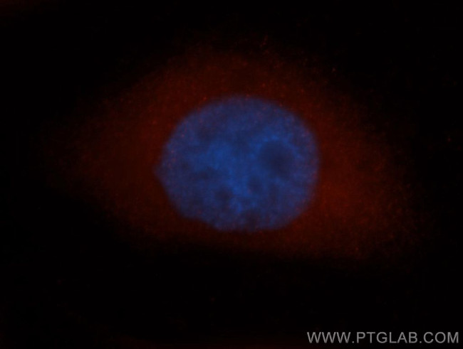CAPG Antibody in Immunocytochemistry (ICC/IF)