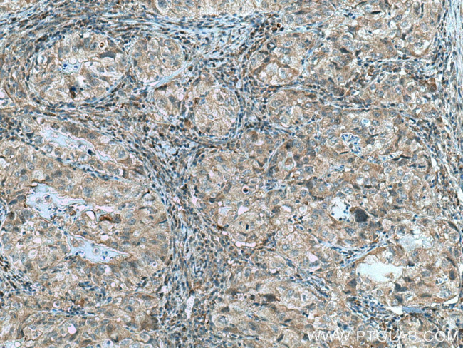 RABEPK/p40 Antibody in Immunohistochemistry (Paraffin) (IHC (P))