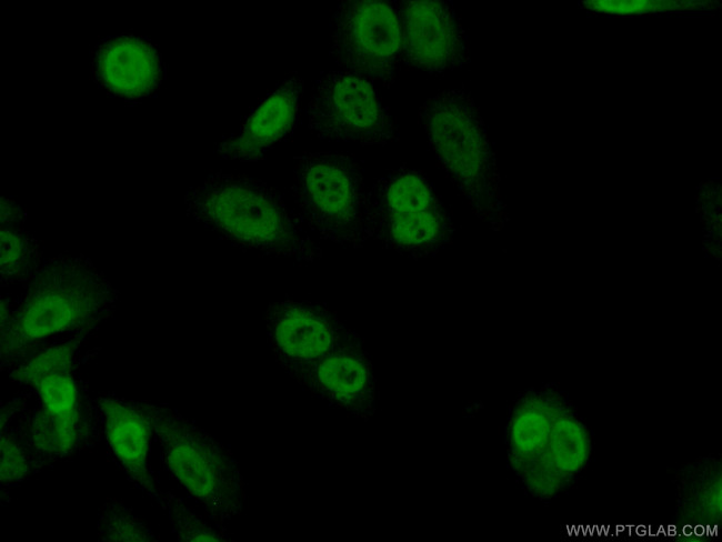 TSC22D1 Antibody in Immunocytochemistry (ICC/IF)
