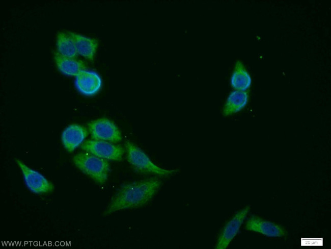 FANCG Antibody in Immunocytochemistry (ICC/IF)