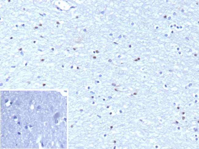 OLIG2 (Marker of Glial Brain Tumors) Antibody in Immunohistochemistry (Paraffin) (IHC (P))