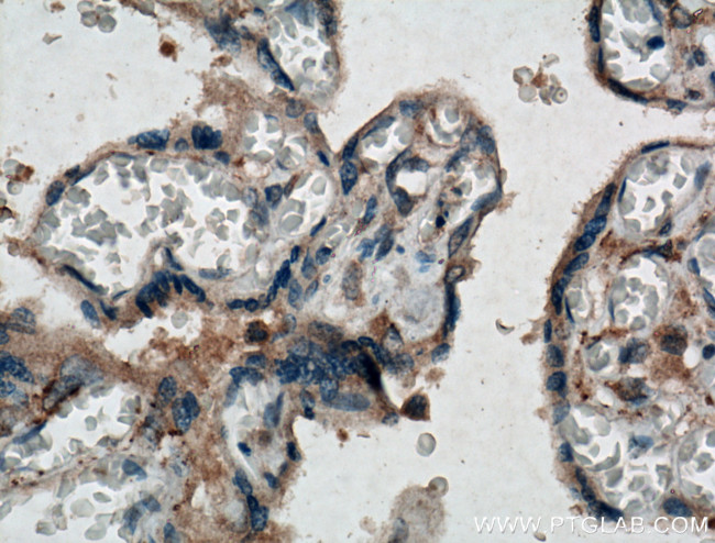 Chemerin Antibody in Immunohistochemistry (Paraffin) (IHC (P))