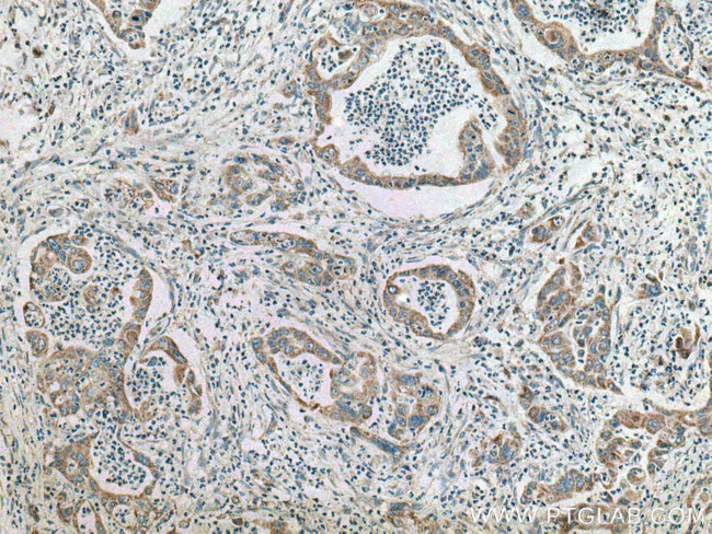 SAPK4 Antibody in Immunohistochemistry (Paraffin) (IHC (P))