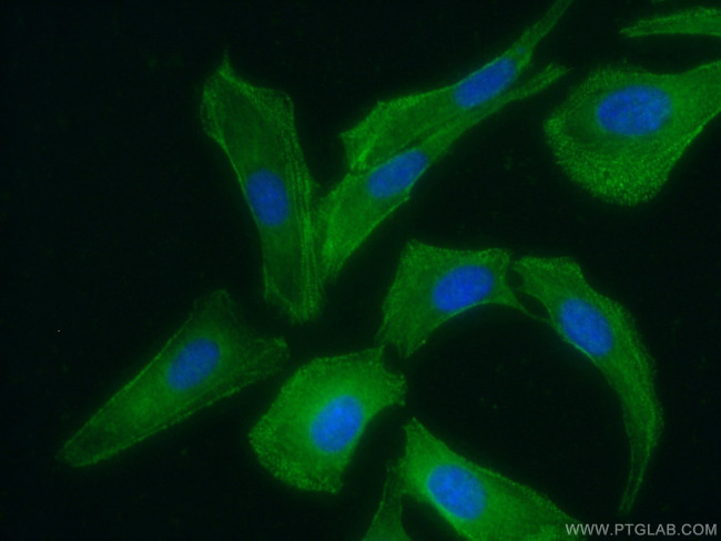 PDLIM7 Antibody in Immunocytochemistry (ICC/IF)