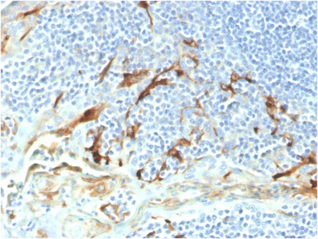 Mesothelin (Mesothelial Marker) Antibody in Immunohistochemistry (Paraffin) (IHC (P))