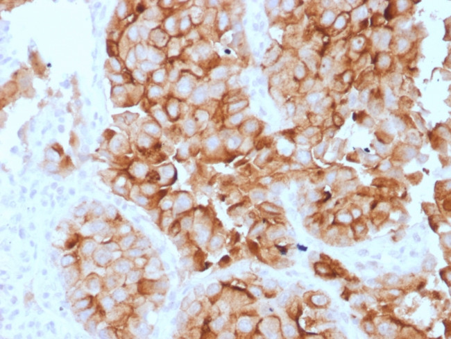 Mesothelin (Mesothelial Marker) Antibody in Immunohistochemistry (Paraffin) (IHC (P))