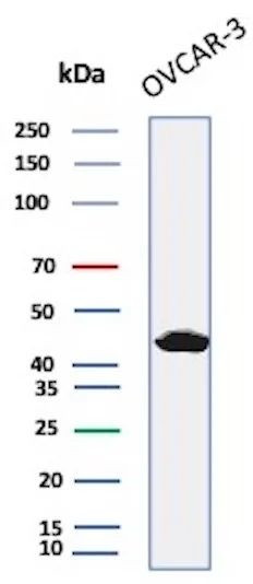 Mesothelin (Mesothelial Marker) Antibody in Western Blot (WB)
