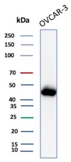 Mesothelin (Mesothelial Marker) Antibody in Western Blot (WB)