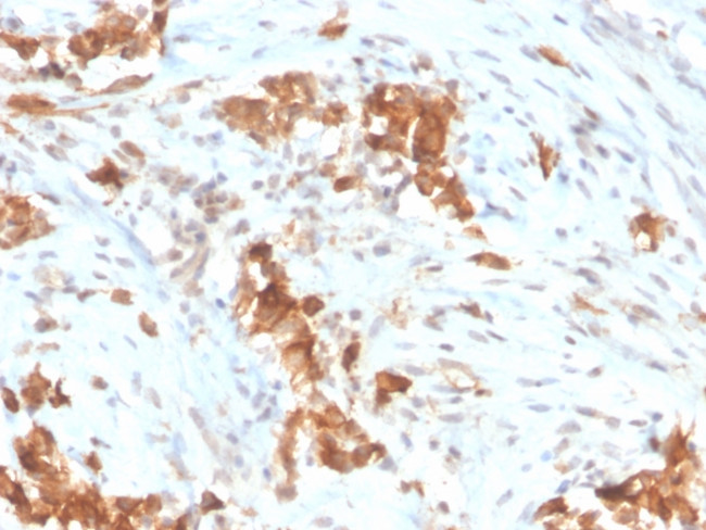 Mesothelin (Mesothelial Marker) Antibody in Immunohistochemistry (Paraffin) (IHC (P))