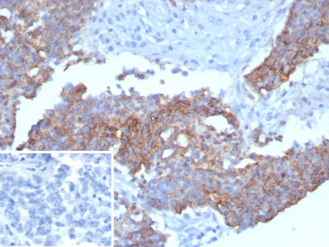 Mesothelin (Mesothelial Marker) Antibody in Immunohistochemistry (Paraffin) (IHC (P))