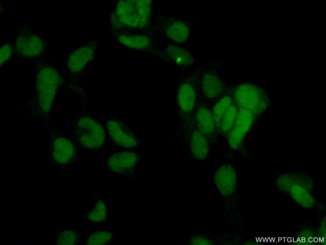 CBX1 Antibody in Immunocytochemistry (ICC/IF)