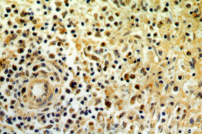 STAT6 Antibody in Immunohistochemistry (Paraffin) (IHC (P))