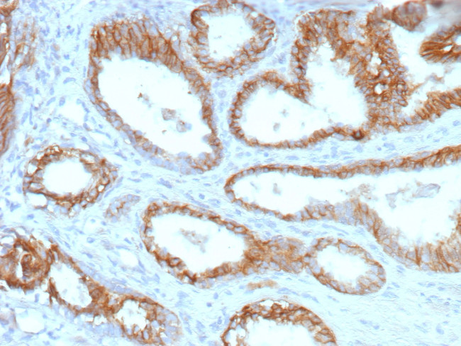 ABCC4/ATP Binding Cassette Subfamily C Member 4 (Drug Target) Antibody in Immunohistochemistry (Paraffin) (IHC (P))