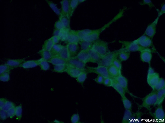 TES Antibody in Immunocytochemistry (ICC/IF)