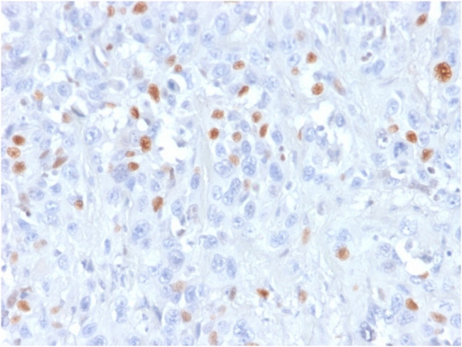 p21WAF1 (Tumor Suppressor Protein) Antibody in Immunohistochemistry (Paraffin) (IHC (P))