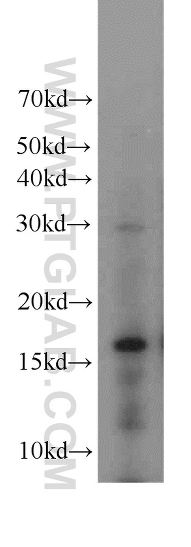 H3F3B Antibody in Western Blot (WB)