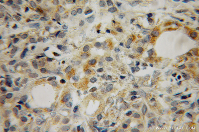 MEA1 Antibody in Immunohistochemistry (Paraffin) (IHC (P))