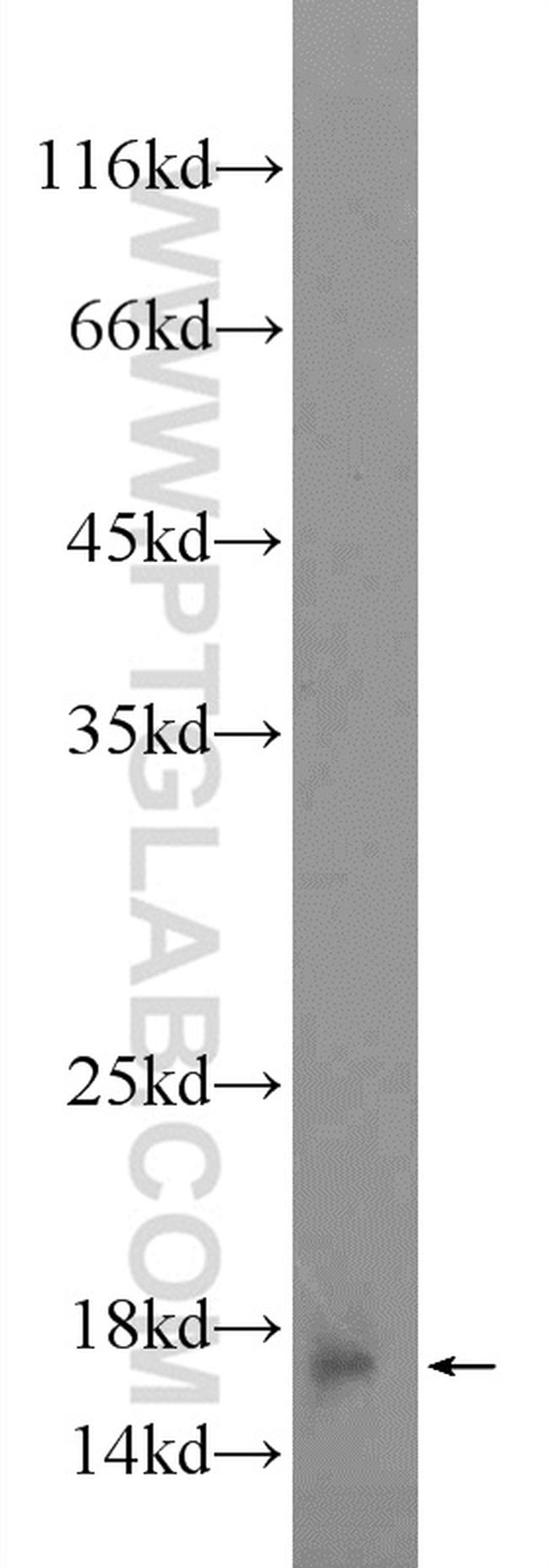 GADD45G Antibody in Western Blot (WB)