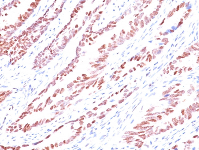 p57Kip2 (Mitotic Inhibitor/Suppressor Protein) Antibody in Immunohistochemistry (Paraffin) (IHC (P))