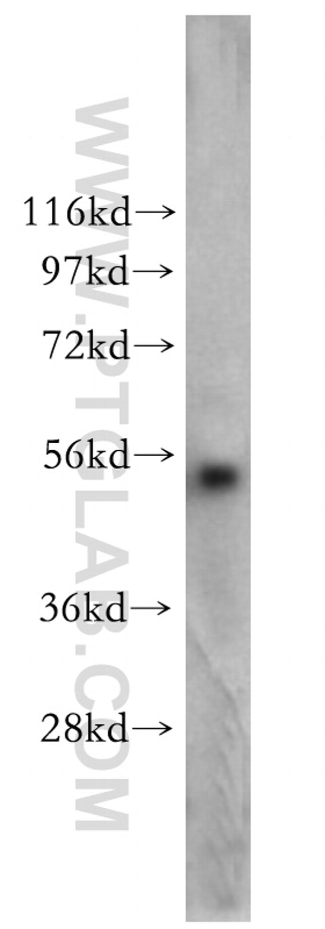 POLD2 Antibody in Western Blot (WB)