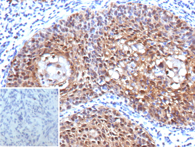 CDKN2A/p16INK4a/p14ARF Antibody in Immunohistochemistry (Paraffin) (IHC (P))