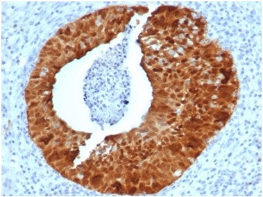 P16INK4a Antibody in Immunohistochemistry (Paraffin) (IHC (P))