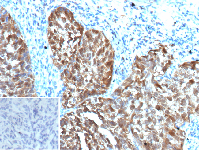 CDKN2A/p16INK4a/p14ARF Antibody in Immunohistochemistry (Paraffin) (IHC (P))