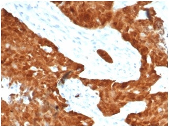 P16INK4a Antibody in Immunohistochemistry (Paraffin) (IHC (P))