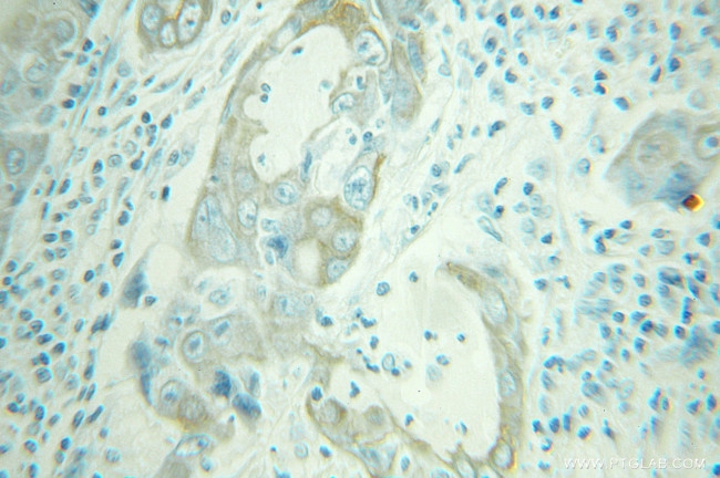 STK16 Antibody in Immunohistochemistry (Paraffin) (IHC (P))